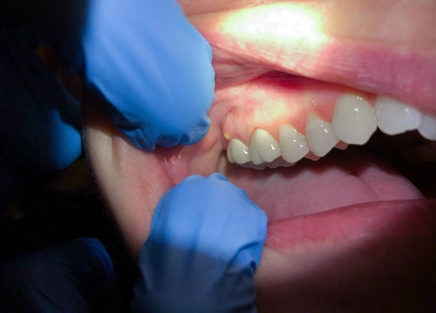 Best Mobile Emergency Dentist in West Monroe, MI