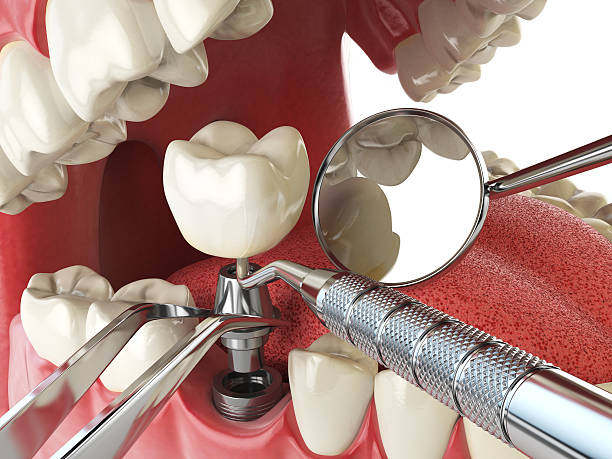 West Monroe, MI Emergency Dentist Pros