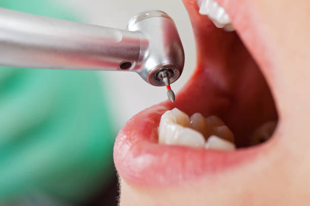Best Weekend Emergency Dentist in West Monroe, MI